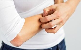 Mâncărimea poate fi numită primul semn al bolii