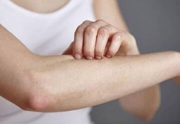 Psoriazisul pe mână