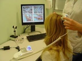 Diagnosticul psoriazisului pe scalp